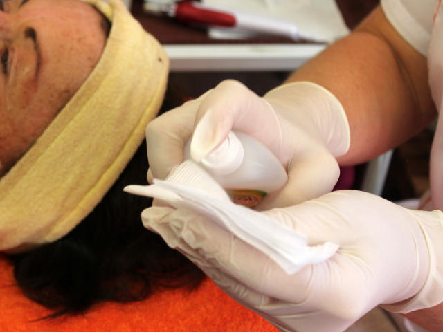 Mezoterapie v salónu krásy Dolce Diva Říčany