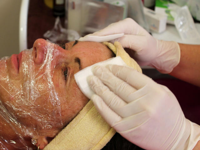 Mezoterapie v salónu krásy Dolce Diva Říčany