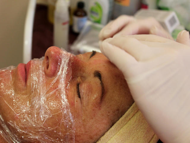 Mezoterapie v salónu krásy Dolce Diva Říčany