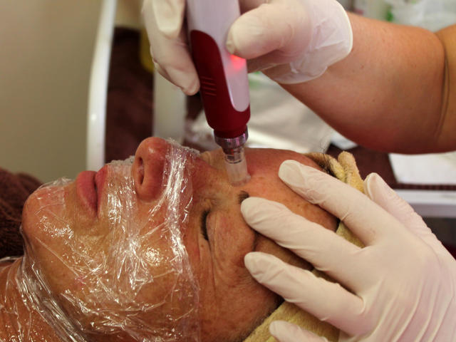 Mezoterapie v salónu krásy Dolce Diva Říčany