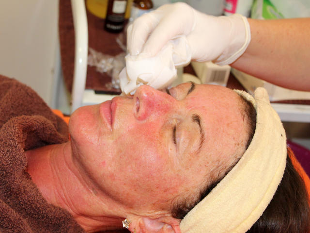 Mezoterapie v salónu krásy Dolce Diva Říčany